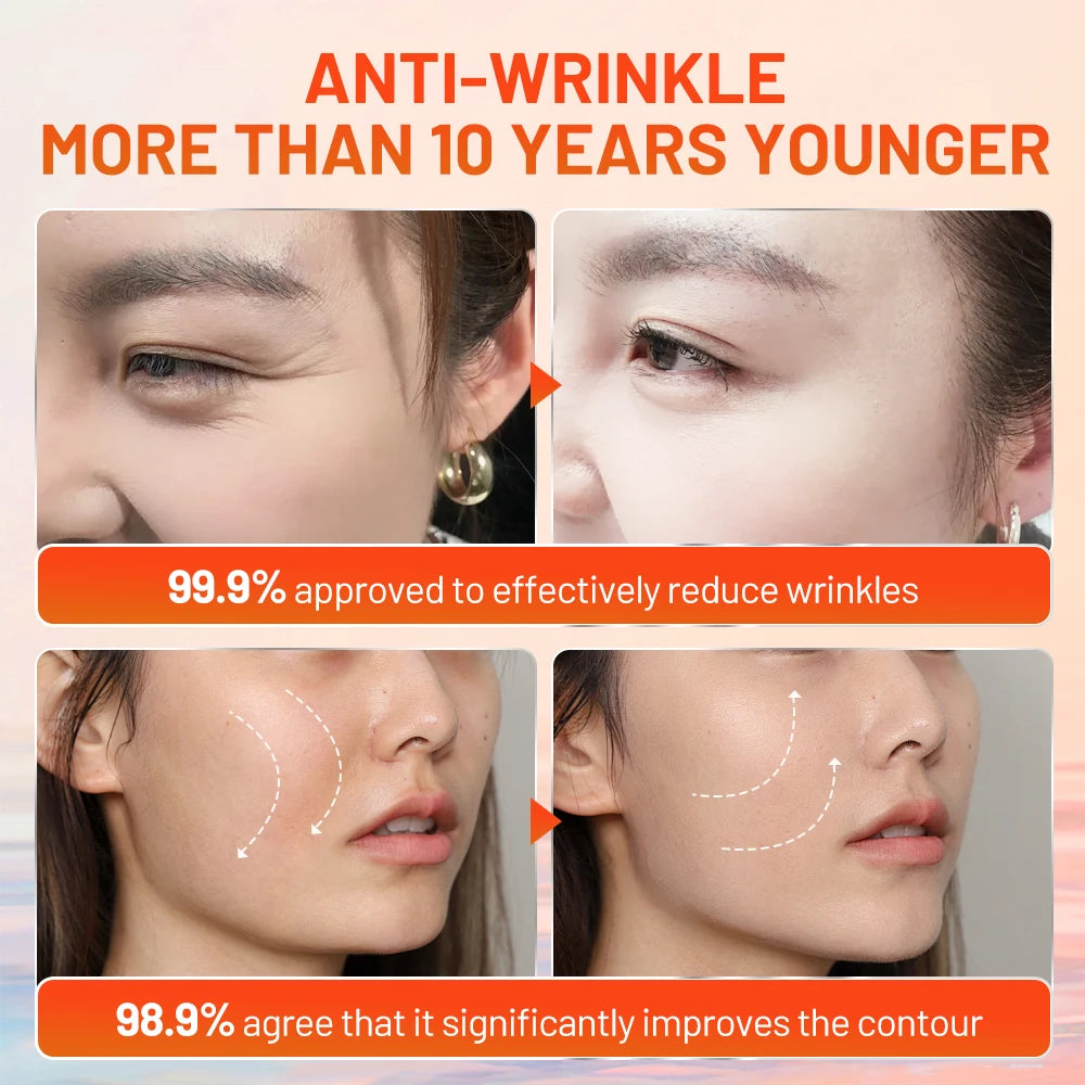 MeiYanQiong Snail Essence with Hyaluronic Acid