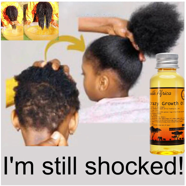 African Layden Hair Growth Oil – Ancient Formula to Strengthen, Lengthen & Restore Hair Naturally
